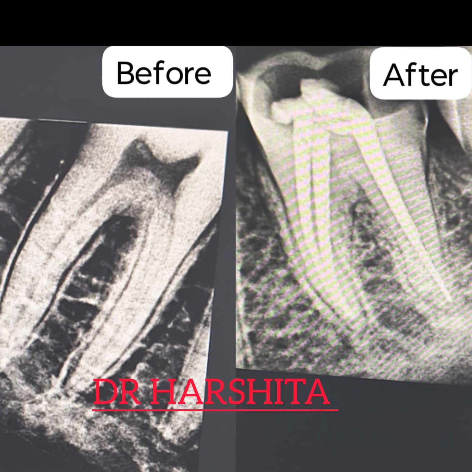 Before & After - Dental Treatment